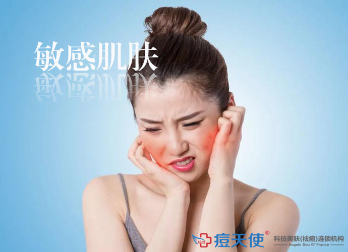 敏感肌肤
