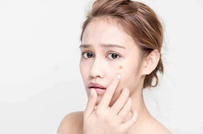 痘印消除的注意事项有哪些