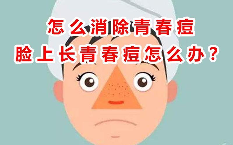 怎么消除青春痘