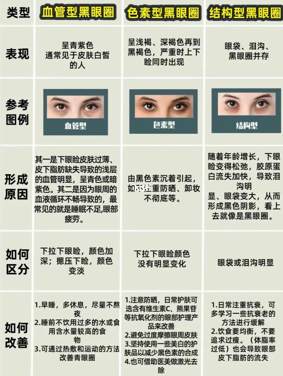 黑眼圈的形成原因
