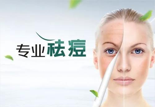 面部清洁的艺术,对抗痘痘的第一步