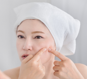 为什么真正有用的祛痘方法这么难找？-痘天使