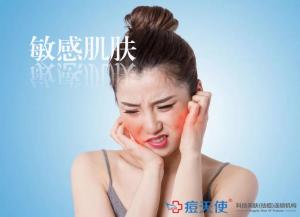 敏感肌肤平时应该怎么改善护理