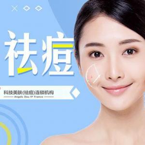 祛痘最好去哪？