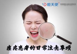痤疮患者的日常注意事项