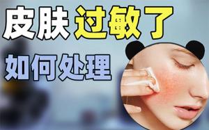 护肤品过敏该怎么办？