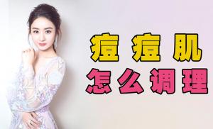 痘痘肌常见问题解答：护肤专家为你解答疑惑