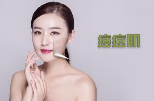 痘痘肌也能水嫩：保湿与修复的重要性