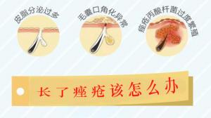 痤疮能否自行改善？痤疮严重该怎么办