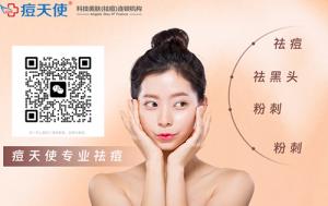 痘天使专业祛痘连锁机构：打造无痘美肌的秘密武器