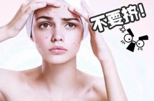 快速祛痘，告别长痘困扰