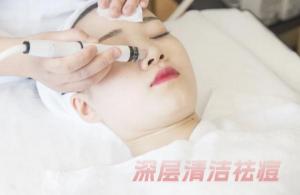 控油祛痘与深层清洁祛痘：有效解决痘痘困扰