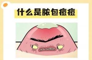 什么是脓包痘痘？如何拯救痘痘肌